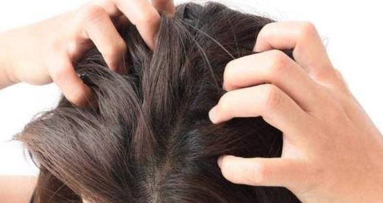头一戴帽子就痒是什么原因?戴帽子头皮痒有什么办法止痒