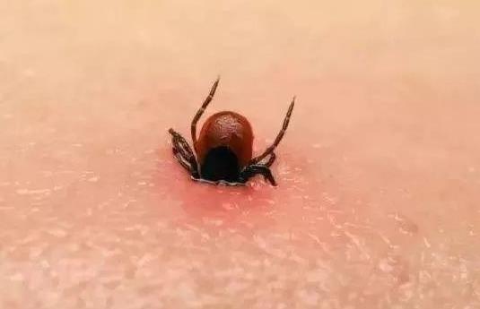 被蜱虫咬了死亡率高吗?被蜱虫咬了一定会得病么?