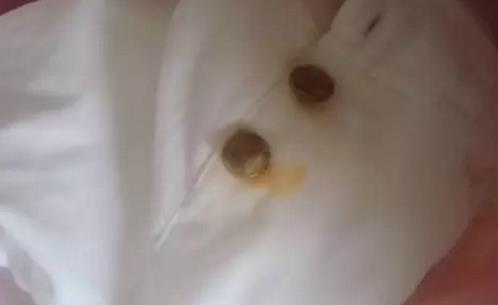 衣服上的铁锈怎么洗?铁锈用什么洗好