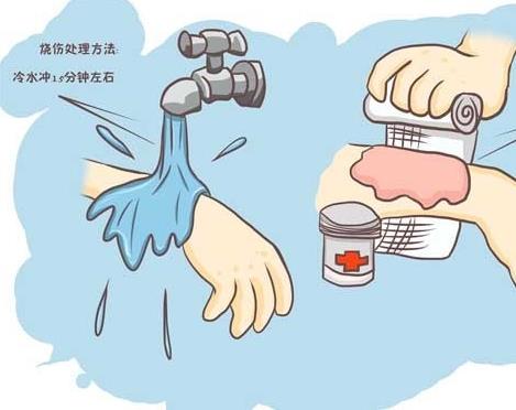 被油烫伤了怎么办?被油烫伤后怎么处理