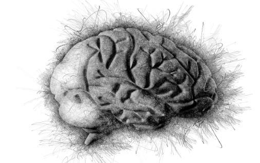 早上起床时出现剧烈的头痛 很遗憾脑出血可能找