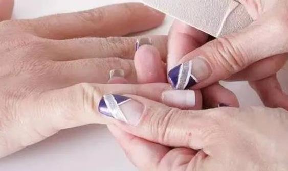 甲沟炎竟是自己作出来的 甲沟炎预防成了关键