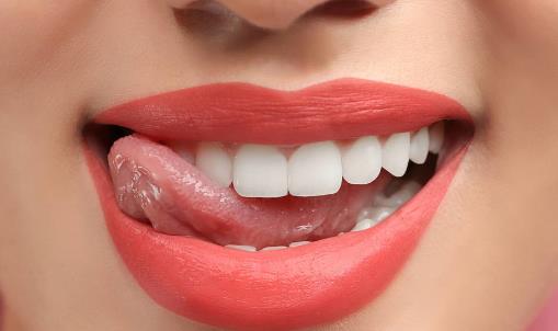牙齿发黄几招帮你洁牙美白 摆脱黄牙困扰坊间小偏方