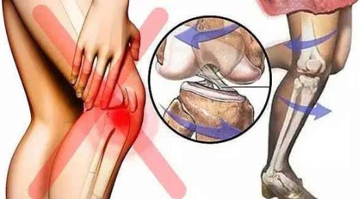 骨科专家称:爬楼爬山是最笨的运动 膝盖磨损严重