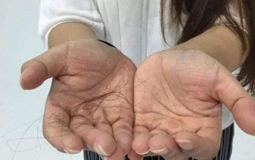 职业女性经常性掉发的原因 脱发的饮食调理